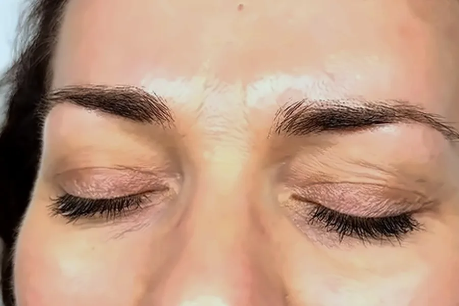 Before: Brow lamination